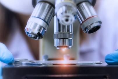 Türk bilim insanları akciğer kanserinde radyoterapiye yanıtı belirleyen 12 gen tespit etti