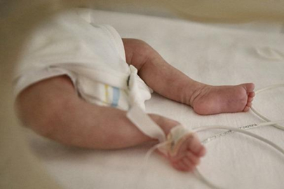 Skandal olay: Muhasebecinin sünnet ettiği 6 aylık bebeğin kalbi durdu!