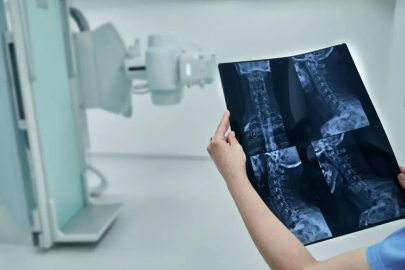 Sağlığın görünmeyen gücü: Radyoloji