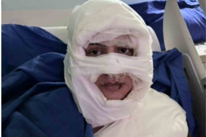 İstanbul'da akıl almaz olay: Genç kadın başka bir kadın tarafından ateşe verildi