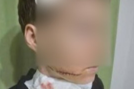 Antalya'da saldırıya uğrayan Ukraynalı kadının kimliği belli oldu