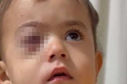 Bursa'da küçük çocuk görme yetisini kaybetmişti! Flaş gelişme: Fırın...