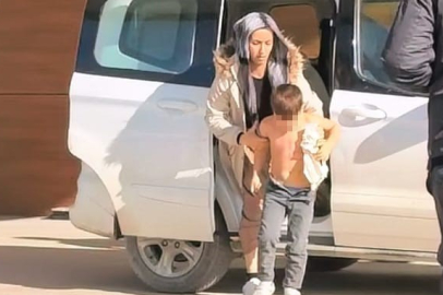 Bursa'da üzerine kaynar su devrilen çocuk yaralandı