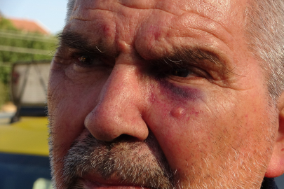 Mersin'de 62 yaşındaki taksiciyi bıçaklayıp darp ettiler