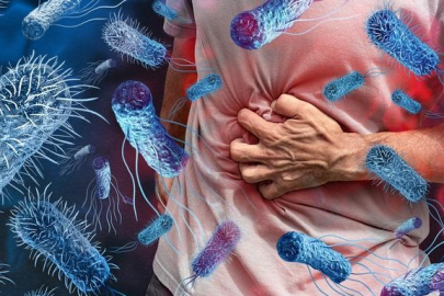 Gıda zehirlenmesi vakaları artıyor! Uzmandan kritik uyarılar...