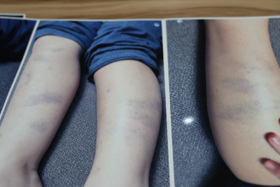 Diyarbakır'da özel okulda 8 yaşındaki çocuğun darbedildiği iddiası