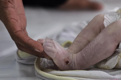 Gazze'de soğuktan bir bebek daha hayatını kaybetti