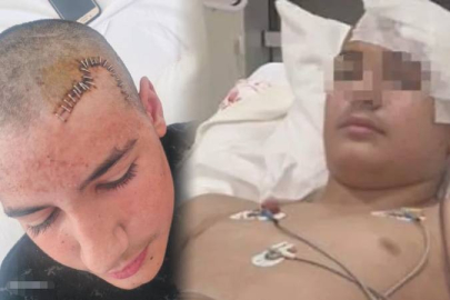 13 yaşındaki çocuğun kafatası taşla kırıldı: Saldırgan "baba tahliye" paylaşımı yaptı!