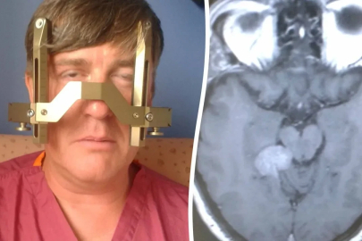 Masum bir kulak çınlaması sandı, altından büyük bir hastalık çıktı: Gerçek, MR taramasında görüldü