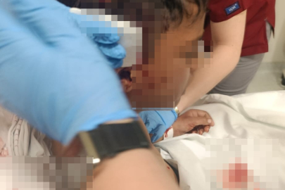 Ankara’da sokak köpeğinin saldırısına uğrayan çocuk yaralandı