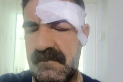 Elazığ'daki kavga, tuvaletini duvara yapan yolcu nedeniyle çıkmış