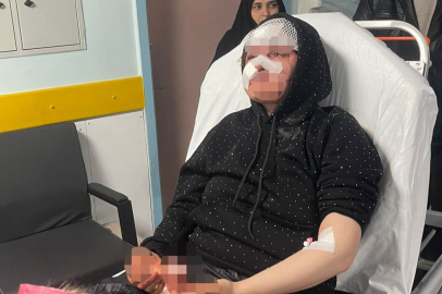 Gaziantep'te boşanmak isteyen kadın eşi tarafından öldüresiye darp edildi