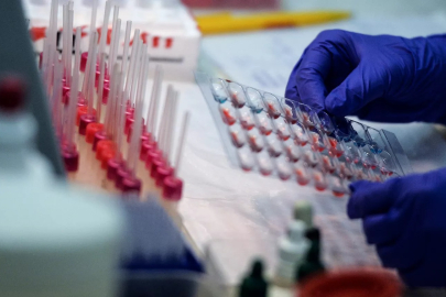 Kanserle mücadelede yeni yöntem!