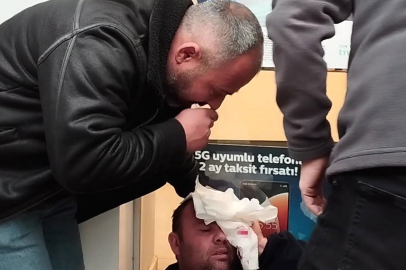 Ordu’da rüzgarda düşen tabela kafasına çarpan belediye işçisi yaralandı