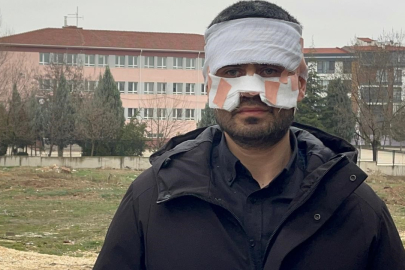 Eskişehir'de rehber öğretmenin yüzüne sıcak çay fırlattığı fizik öğretmeni feci şekilde yandı