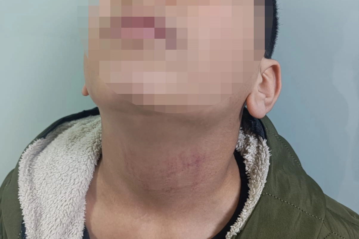 İstanbul Küçükçekmece'de kadın memurun 10 yaşındaki öğrenciyi okulda darbettiği iddiası