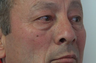 İstanbul Ümraniye'deki ikinci cinayette acılı baba fenalaşarak hastaneye kaldırıldı