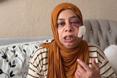 Elektrikli bisikletle rögara düştü! Tanınmayacak hale geldi..