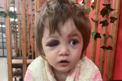 Yalova'da 14 aylık bebeğin yaralandığı komşu kavgasıyla ilgili baba ve anne ifade verdi