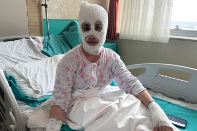 Sobanın üstündeki düdüklü tencere bomba gibi patladı