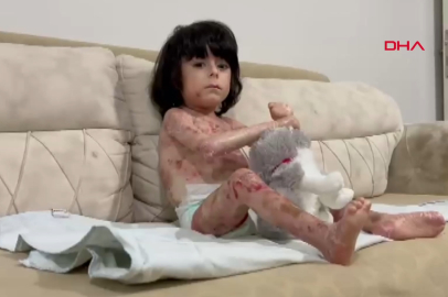 Bursa'da minik İbrahim'in yürek yakan hastalığı! Aile çaresiz durumda...