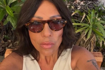 Işın Karaca’nın son paylaşımı yürekleri ağza getirdi! Kemikleri sayılıyor, akıllara Nihan Candan geldi