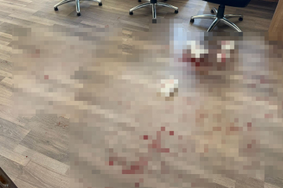 Yozgat'ta okul müdürünü darbeden saldırgan tutuklandı