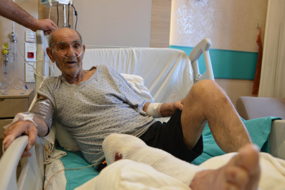 Tıkalı lavaboyu açmaya çalışırken kimyasal yanıkla hastanelik oldu