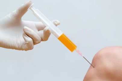 PRP ve kök hücre tartışması: Gerçekler ve yanlış bilinenler