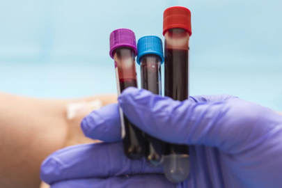 En riskli kan grubu ortaya çıktı! Kalp krizi ihtimali...