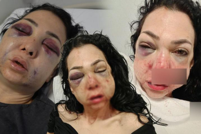 Anne ve oğlunu feci şekilde darp ettiler! Tanınmaz hale geldi: Tehdit ediliyorum