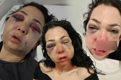 Türkiye bu olayı konuşuyor! Anne ve oğlunu feci şekilde darp ettiler...