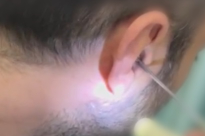 Kayseri'de kulağına gizlediği uyuşturucuyla yakalandı