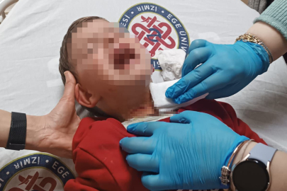İzmir'de parkta oynayan 2 yaşındaki çocuğa bıçaklı saldırı