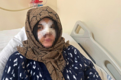 Gaziantep’te eşinin yüzünü taşla ezip darbeden sanık ağır cezada yargılanacak