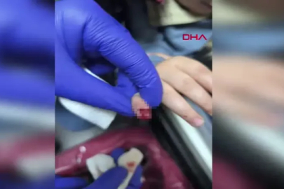 AVM'de yürüyen merdivene eli sıkışan çocuğun parmağı koptu