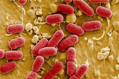 Bağırsaklardaki gizli tetikleyici: ALS ve demansın nedeni olabilir