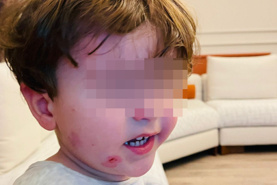 Bursa'da kreşe bıraktığı çocuğunu darp edilmiş halde aldı