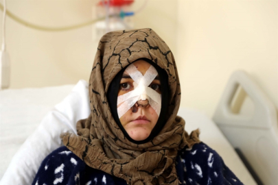 Boşanma aşamasındaki eşine vurduğu kaldırım taşı 'silah' sayıldı