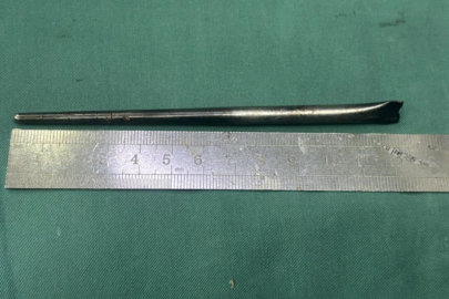 Ağrı şikayetiyle doktora gitti: Boğazından çıkana doktor da inanamadı! Tam 12 santimetre