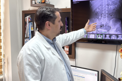 İdrar kanalından 51 taş çıkarıldı