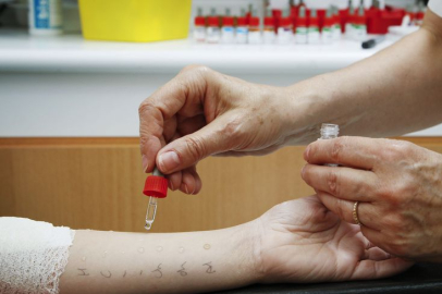 Bursa, bağışıklık bilimcileri ağırlayacak...