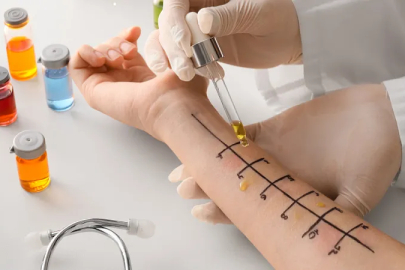 Türkiye'nin alerji haritası belli oldu! Marmara’da akar, Ankara’da polen...