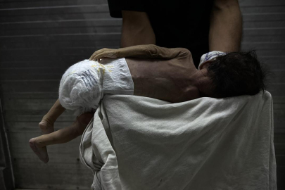 Gazze'de savaşın gölgesinde bebek ölümleri ve doğum kusurları artıyor