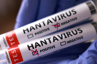İngiltere: Bir İngiliz vatandaşında daha hantavirüs şüphesi tespit edildi
