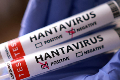 İngiltere'de bir kişide daha hantavirüs şüphesi tespit edildi