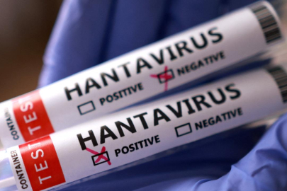 Hantavirüs'de son durum: Birçok ülke vatandaşlarını tahliye için bekliyor