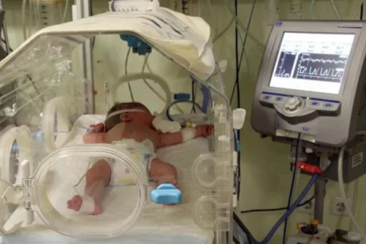 Kuvözde korkunç ihmal: 17 günlük bebeğin kolu yandı!