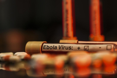 Ebola mücadelesine Batı'dan bütçe darbesi: Salgın küresel riske dönebilir