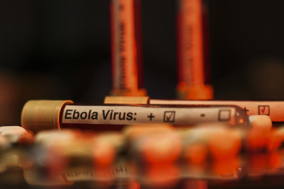 ABD'den Ebola uyarısı: Tarihin en ölümcül seviyesine ulaşabilir
